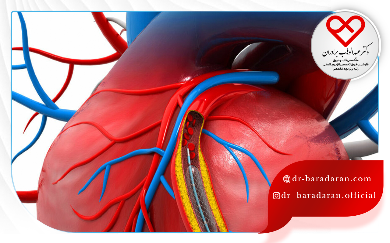 3 مزیت بارز بالن زدن یا آنژیوپلاستی قلب
