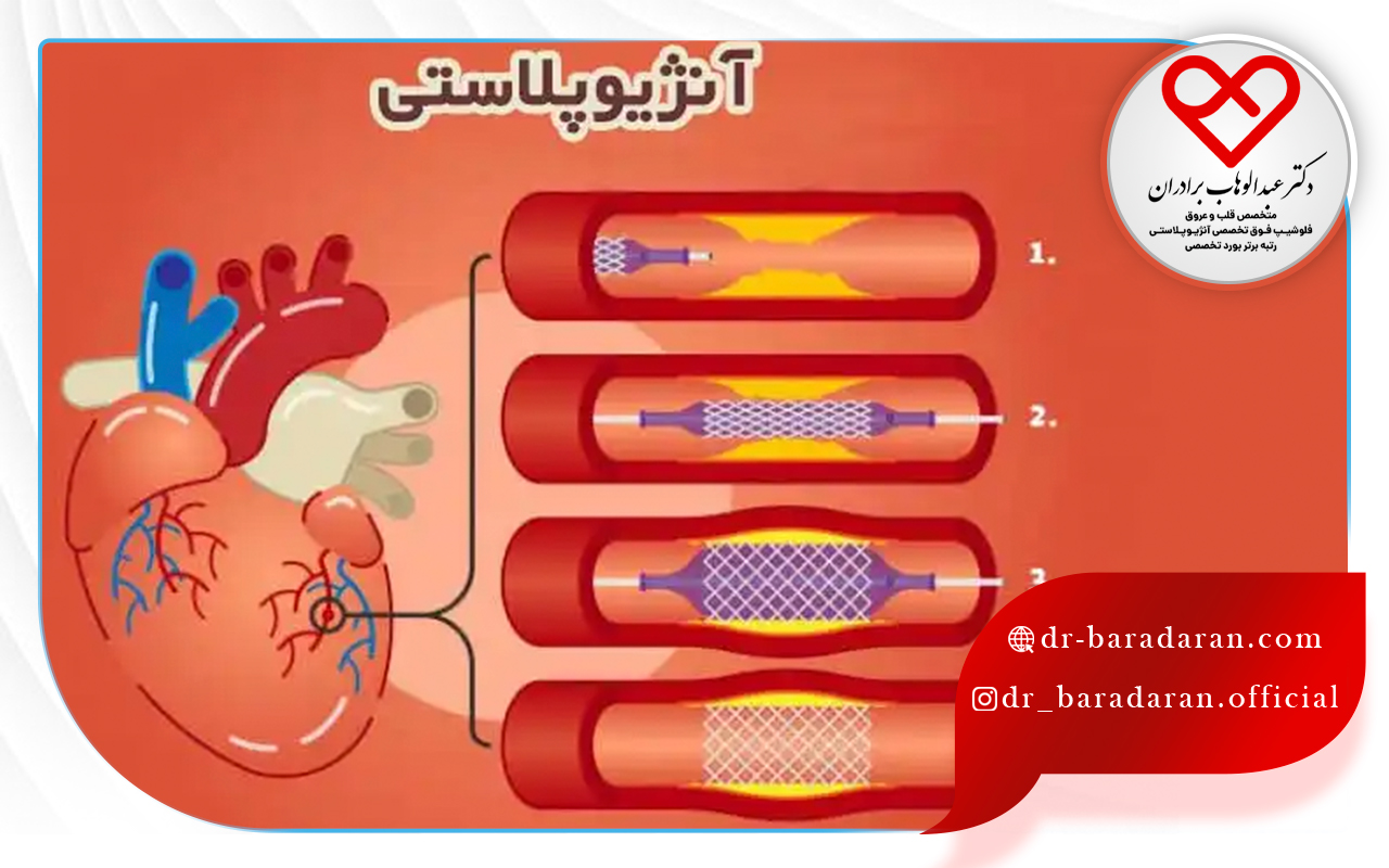 نحوه عملکرد بالن قلب چگونه است؟