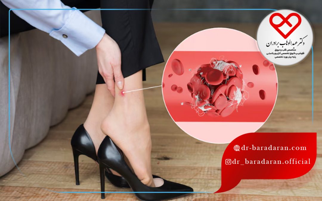 تشخیص لخته شدن خون در پا