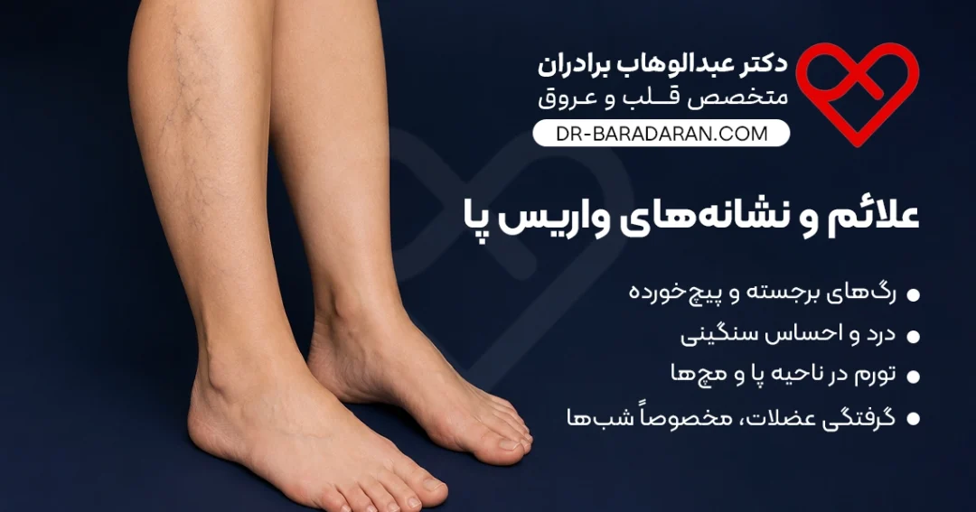 علائم و نشانههای واریس پا شامل رگهای برجسته و پیچخورده، درد، احساس سنگینی، تورم پا و مچ، و گرفتگی عضلات، معرفی خدمات تخصصی دکتر عبدالوهاب برادران متخصص قلب و عروق
Symptoms and signs of leg varicose veins including bulging and twisted veins, pain, heaviness, swelling in the legs and ankles, and muscle cramps, by Dr. Abdolwahab Baradaran, cardiologist and vascular specialist